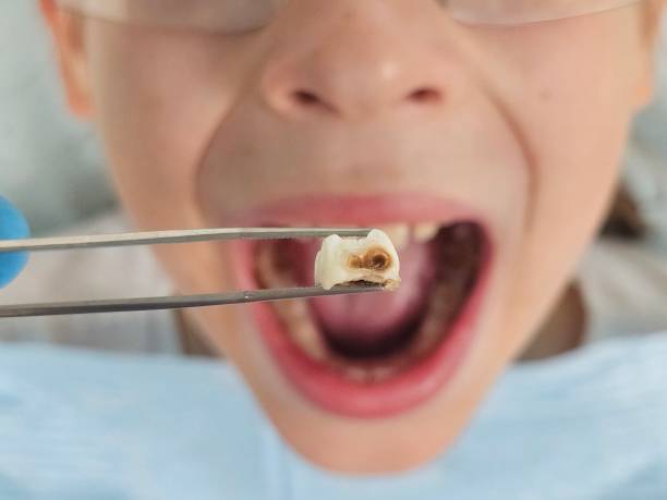 Best Cracked Tooth Emergency Dentist  in Shrub Oak, NY